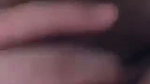 1000157632