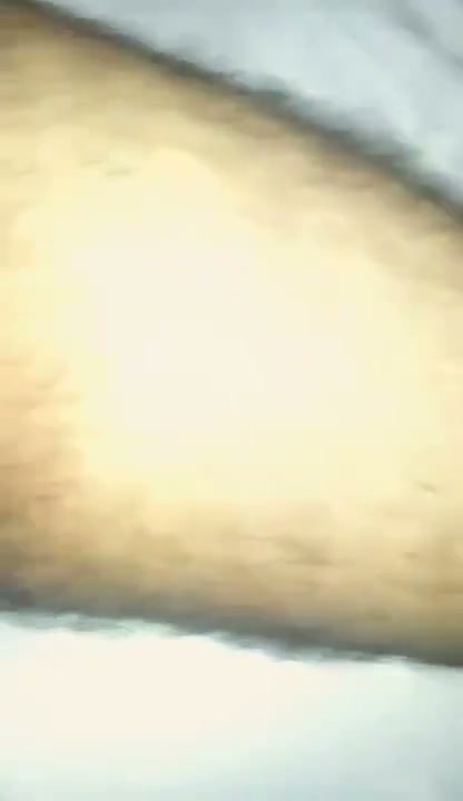 Frame 5