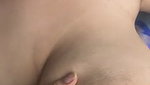 1000126420