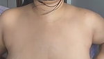 1000126420