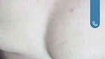 1000271069