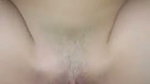 1000294557
