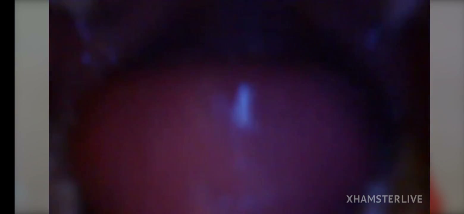 Frame 10