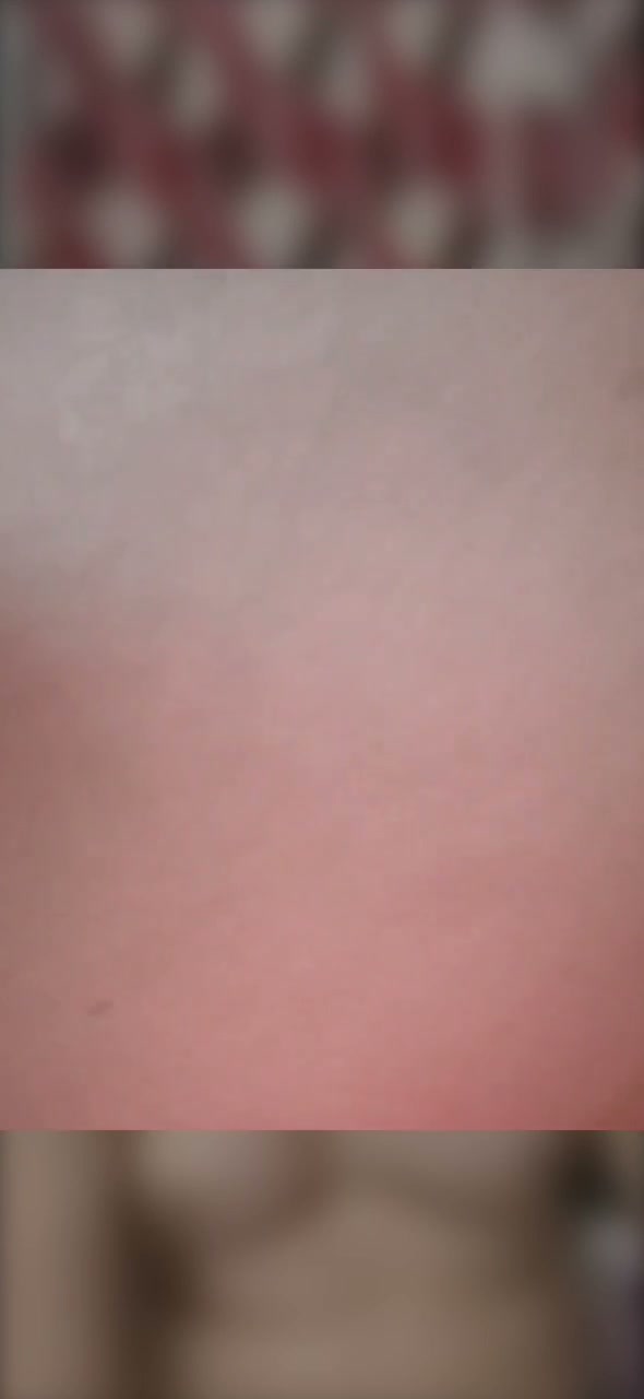 Frame 2