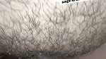 1000228548