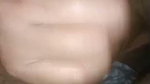 1000228544