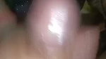 1000228544