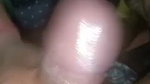 1000228544