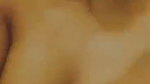 1000740983