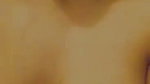 1000740983