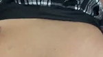 1000741038