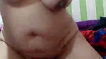 1000605699