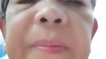 1000605698