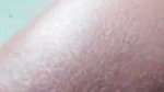 1000605697