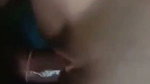 1000165395