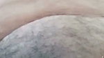 1000606655