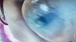 1000606661