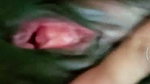 1000606704