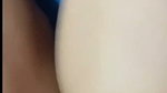 1000419339