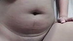 1000271072