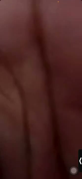Frame 7