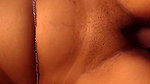 1000300472