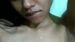 MYL 25