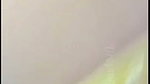 1000141154