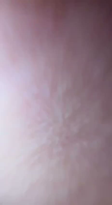 Frame 5