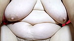 1000329336