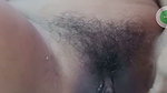 1000072479