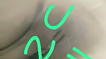 1000238938