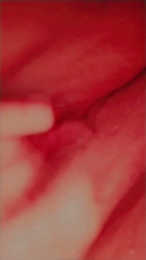 Frame 2