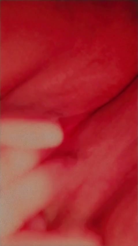Frame 4