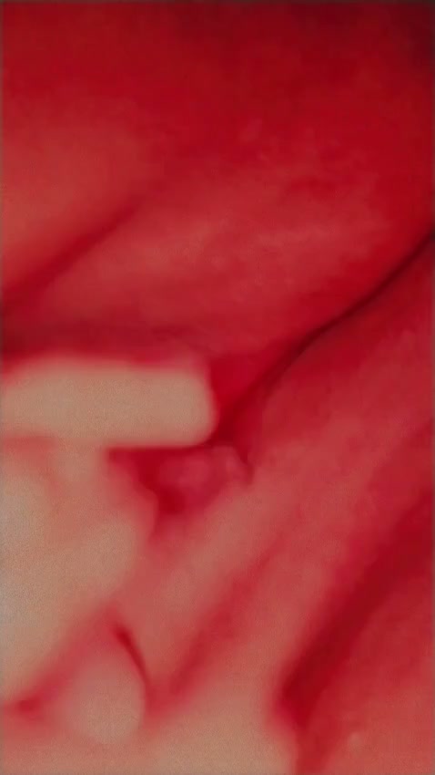 Frame 6