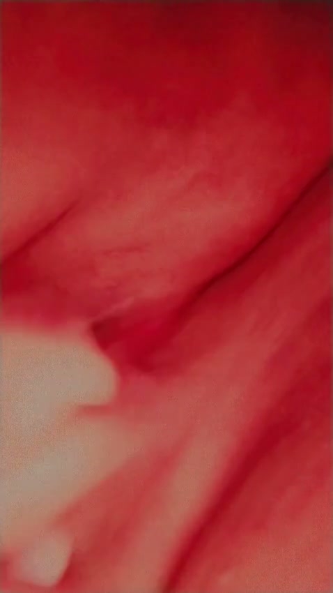 Frame 7
