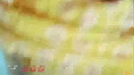 1000331956