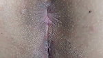 1000273321