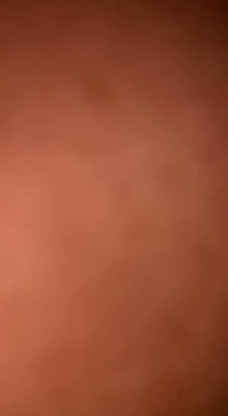 Frame 6