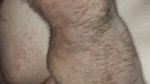 1000246954