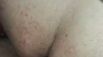 1000246954