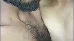 1000147476
