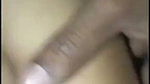1000147476