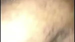 1000147476