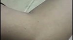 1000147476