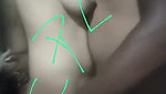 1000247515