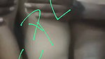 1000247515