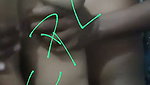 1000247515