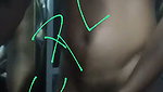 1000247515