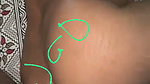 1000247514